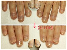 リラマジック (Rela-Magic)/深爪