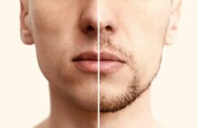 ビューティーサロン フェリーチェ 脱毛店