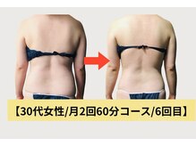 ネオボディ(Neo Body)の雰囲気（施術6回目！自分ではケアが難しい腰回り&背中、くびれも◎）