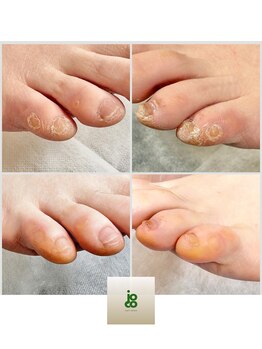 ジョーコーネイル(joco nail)/