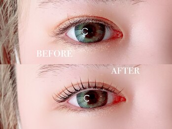 リー(Rii)/ビフォーアフター＊