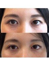 アンベリール みなとみらい店(Embellir)/まつげパーマ