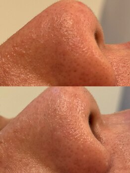 セレニテ(Serenite)/