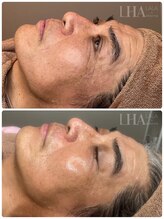 ラディアント たまプラーザ/「ララピール」ビフォーアフター