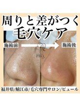 ピュール 鯖江店(PUR)/毛穴サロン/毛穴ケア/毛穴洗浄