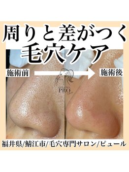 ピュール 鯖江店(PUR)/毛穴サロン/毛穴ケア/毛穴洗浄