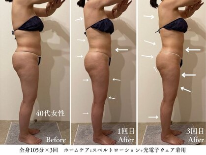 クレンズ(CLeanse)の写真