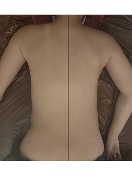 リコ(Relaxation Boutique LICO)/左Before/右After