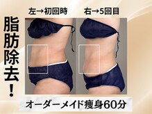 イヨヨ(iyoyo)/【痩身】Before After