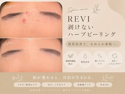 ラピスビューティーサロン(Lapis beauty salon)の写真