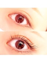 イーエヌトリップ(en.trip)/フラットラッシュ140本