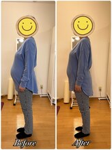 クルミ(Kurumi)/マタニティ整体の効果