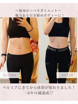 ベルミア(Bellemia)/ダイエット・姿勢サポート