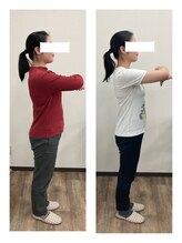 わたなべ接骨院 プラスラボ(+LABO)/お腹周りスッキリ-8.4キロ減！