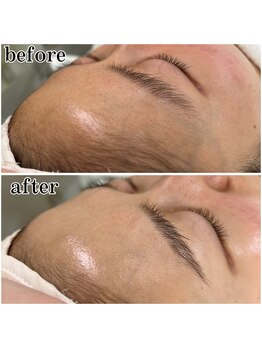 シェクラ(SHECIA)/瞬間ツヤ肌!