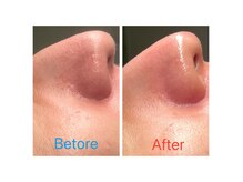 ピュアスキンラボ(PureSkinLab.)