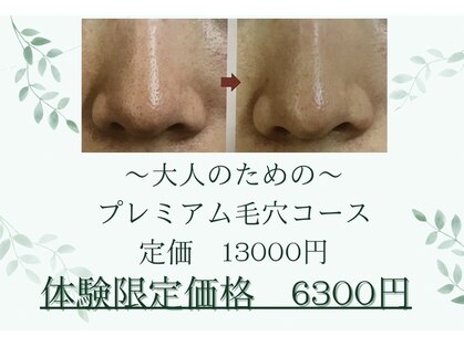 コルッソ(CoLusson.)の写真