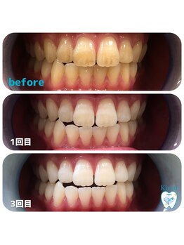 キラット 高知店(Kiratt)/毎日たばこを吸うお客様