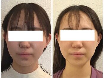 ウェリナ 一宮院/小顔矯正/骨盤矯正/痩身整体