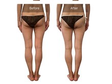 ベンザイ 梅田店(BENZAI)/骨盤の歪み、姿勢改善