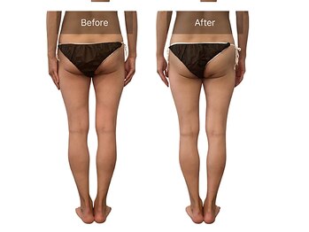 ベンザイ 梅田店(BENZAI)/骨盤の歪み、姿勢改善