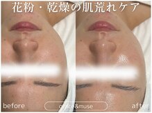 グレイス アンド ミューズ(grace&muse)/《CHRISTINA》アンストレス