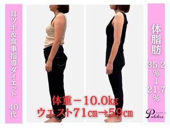 プルクレ 常磐町店(Pulchre)/お腹周り注目!
