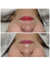 サラン(SALON)/お顔　ビフォーアフター