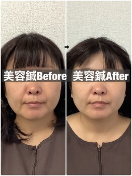 ハリサロンドオフ 堺東店(hari salon de off)/お客様before→after