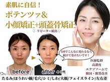 アメリイ 百合ヶ丘 新百合ヶ丘(Amerii)