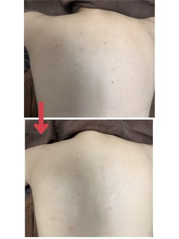 スリリアン 銀座/★お客さまビフォーアフター★