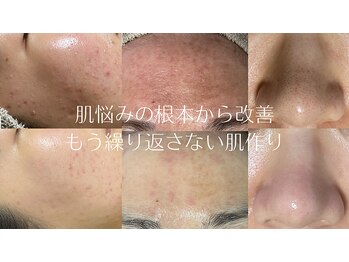 ユイット ルッカ(Huit Lucca)