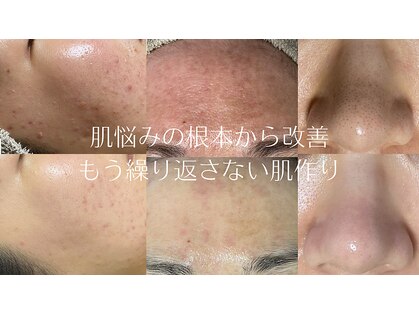 ユイット ルッカ(Huit Lucca)の写真