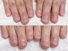 グレースレディ 大阪店/(深爪/長さだし/フィルイン)