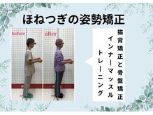 ほねつぎ長嶺鍼灸接骨院