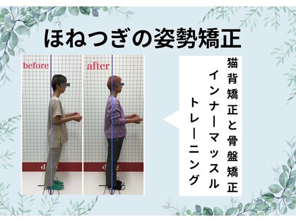 ほねつぎ長嶺鍼灸接骨院の写真