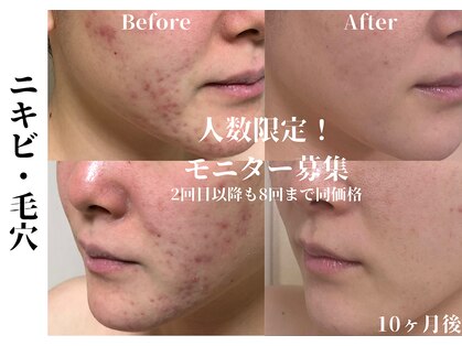 ローズフィールド(Rosefield)の写真