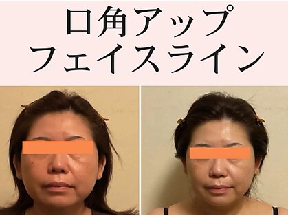 シエル(CIEL)の写真