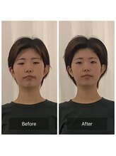 美容整体プラスフィール 横浜店/美容整体/エステ/リラク