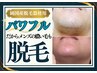 【お試し体験/ヒゲ脱毛】面倒な髭剃りから解放され清潔感UP♪￥5000→￥3800