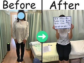杉本接骨鍼灸院/ 【ダイエット】55歳　11.0キロ