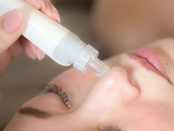 ホワイトニング カフェ オオタ(Whitening Cafe Ota)の写真/【迷ったらおすすめ！】まずはお顔のお掃除から★フォト美顔＋ハイドラフェイシャル¥8800～
