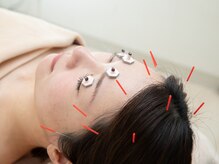 本厚木鍼灸整骨院