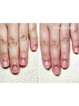 爪の悩みを解消できる（ケア含む）