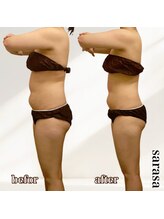 ナチュラル ビューティー スタイル さらさ(Natural Beauty Style)/来年に向けスリム化◎モニター様