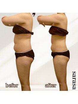 ナチュラル ビューティー スタイル さらさ(Natural Beauty Style)/来年に向けスリム化◎モニター様