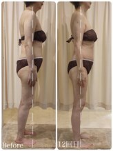 ルノン(Lunon)/《全身歪み改善》姿勢・重心改善