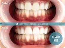 セルフホワイトニング専門店 シマエナ上新庄駅前店/初めての方も1回で実感
