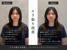 美整庵 谷山店(BISEIAN)/食いしばり エラ張り改善