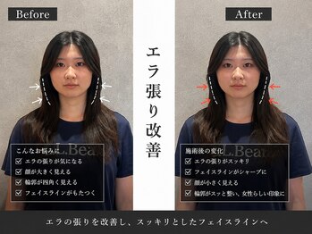 美整庵 谷山店(BISEIAN)/食いしばり エラ張り改善
